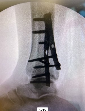 IMG_3002.jpeg IMG_3002.jpeg